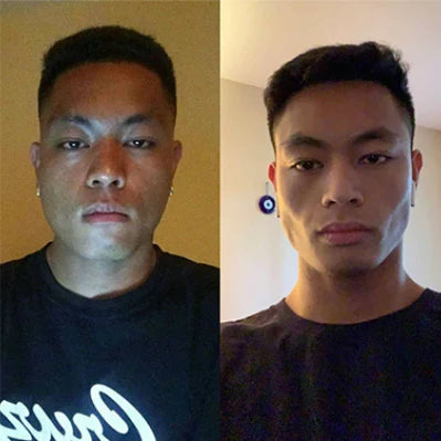 Photo avant et après d'un utilisateur, fournie par le fournisseur